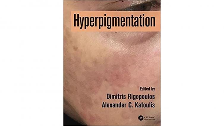 书名: Hyperpigmentation