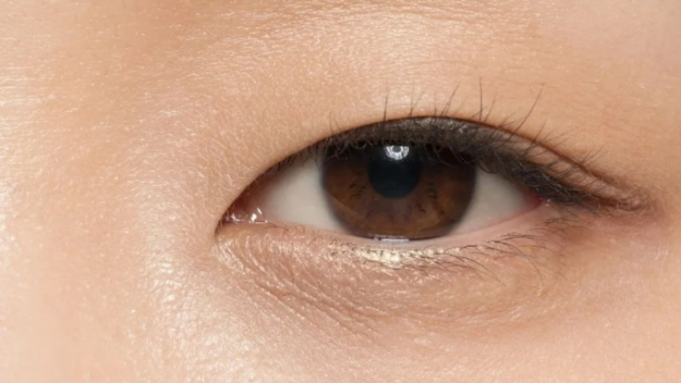医美优质文章推荐: 肿眼泡不一定是脂肪多，不同类型的眼肿泡该如何做双眼皮？